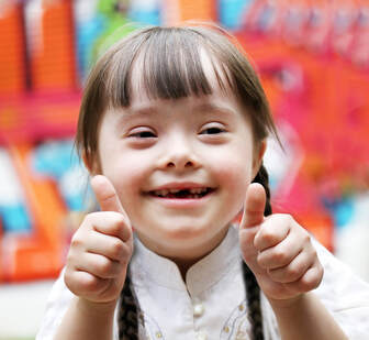 Little girl with Down Syndrome smiling and giving thumbs up.